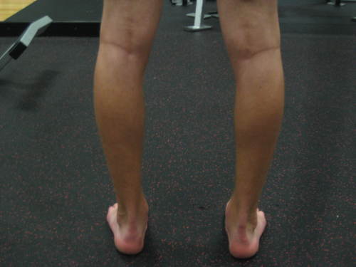 Endeavor Sports Performance-Over Pronation Effects on Knee